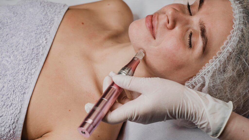 Microneedling Mesotherapy