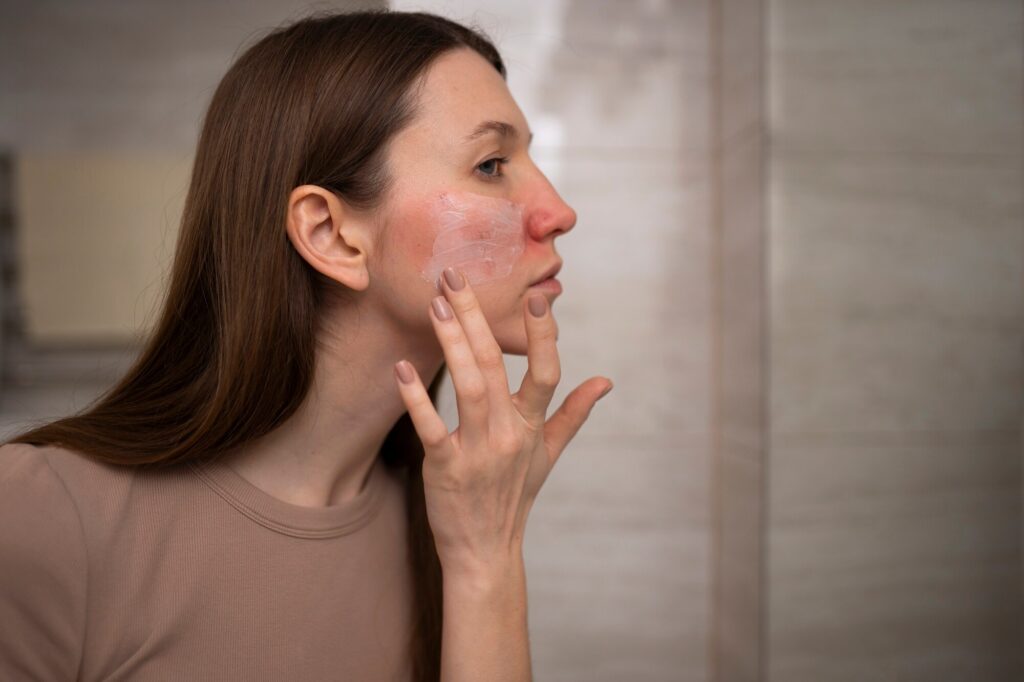 How to Remove Facial Redness
