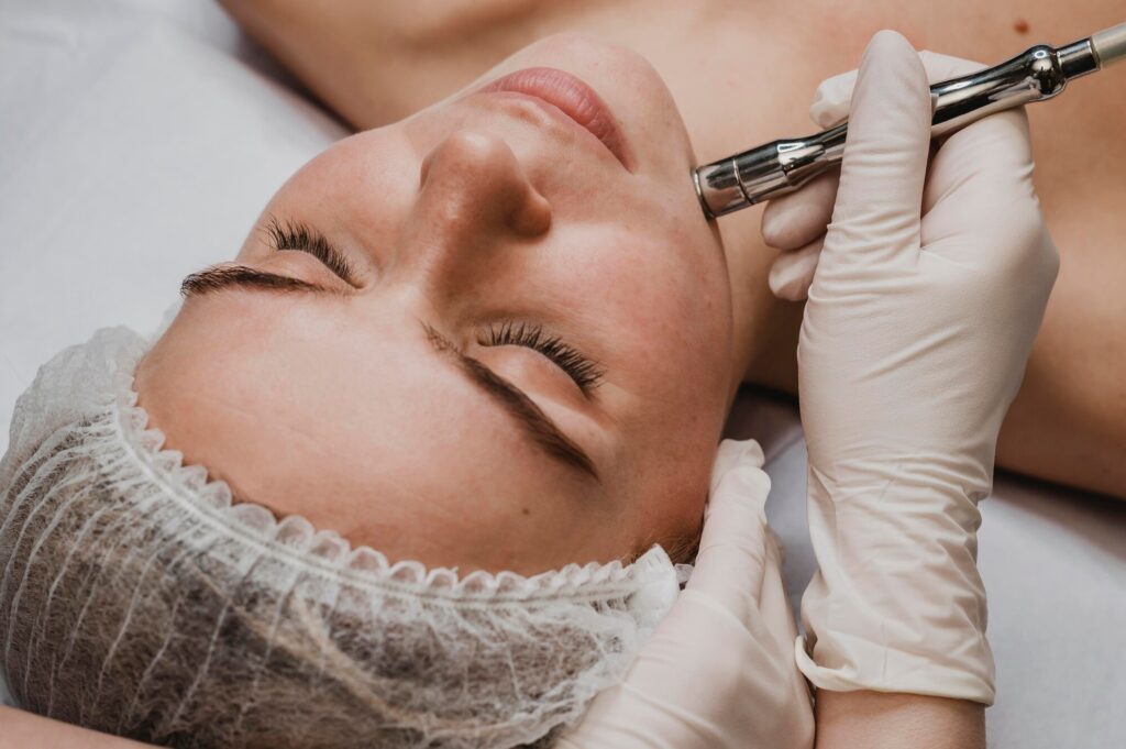 What Is Microneedling