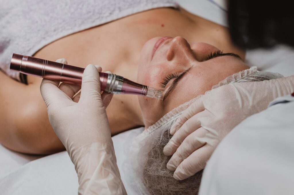 What Is Microneedling and When Is It Most Effective
