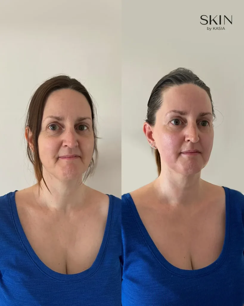 before and after 16