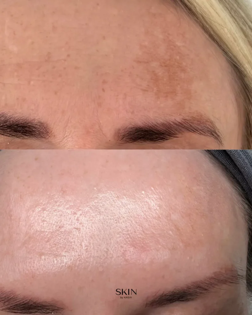before and after 19
