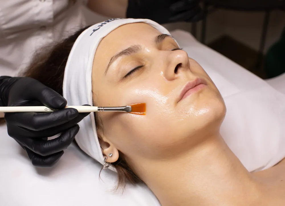 ALUMIER MD Chemical Peels